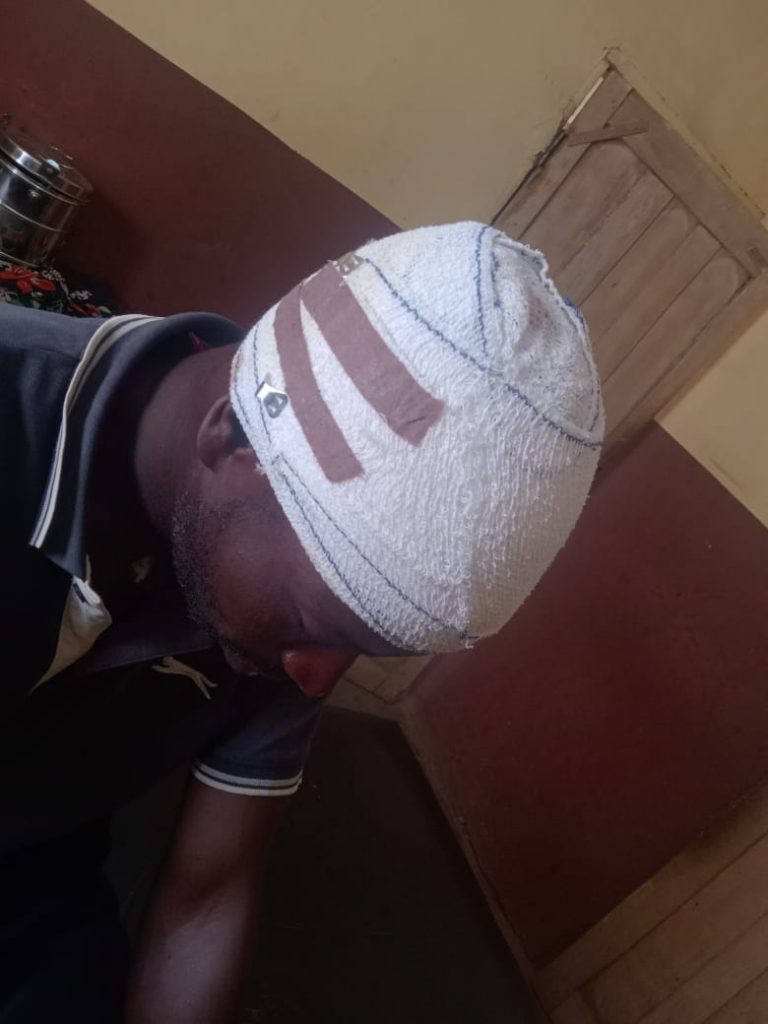 Ogun corps nabs motorbike hijacker, hits rider with shovel