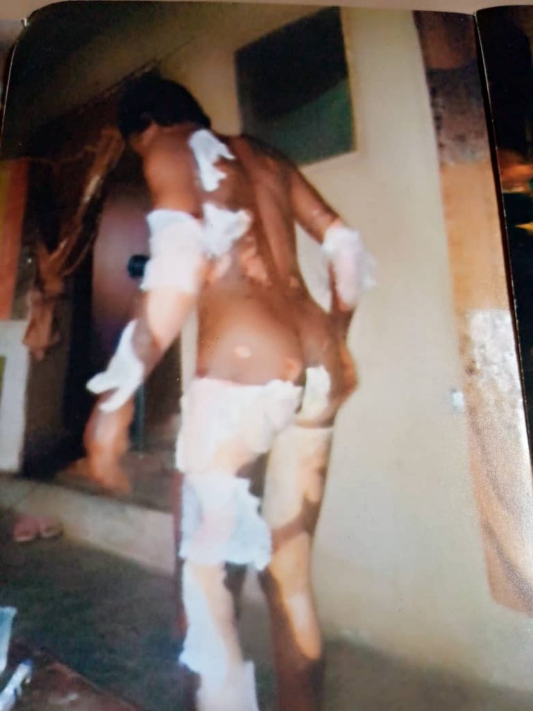 Man, 41, arrested for setting wife ablaze in Ogun
