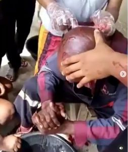 IKEDC-Staff-stabbed-on-the-head