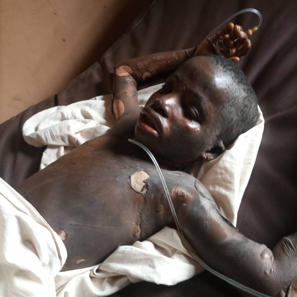 mother set son ablaze