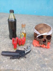 Police arrest cult-related assault suspect, recover firearm, skull