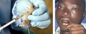 Lassa fever kills 229 as cases rise nationwide