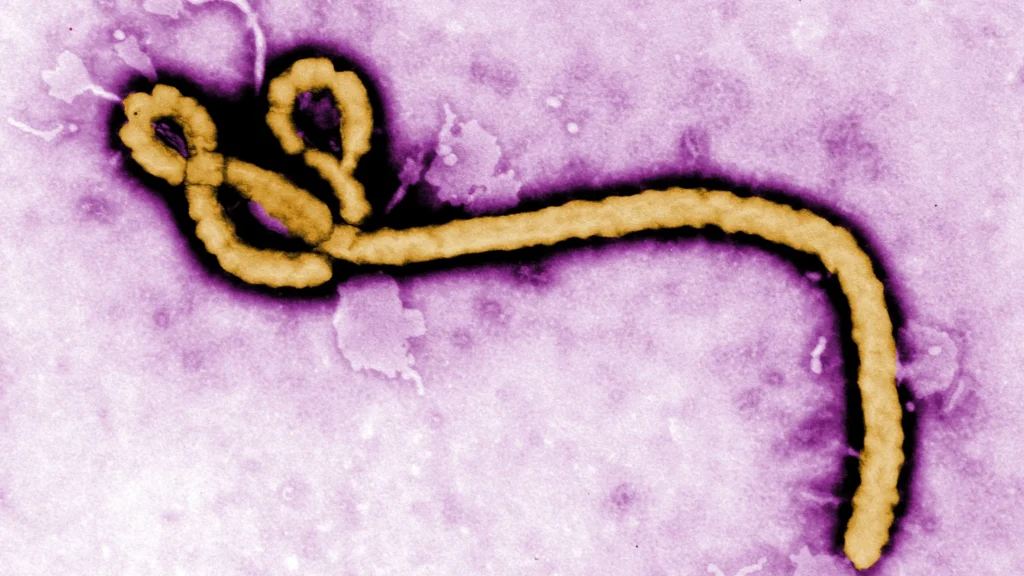 Ebola patient flown to Switzerland as Nigeria tracks contacts
